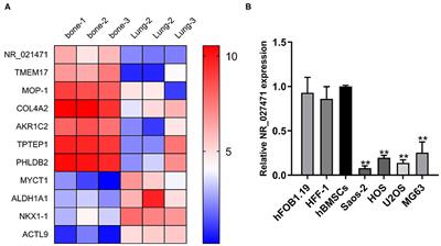 LncRNA NR_027471 Functions as a ceRNA for miRNA-8055 Leading to Suppression of Osteosarcoma by Regulating the Expression of TP53INP1